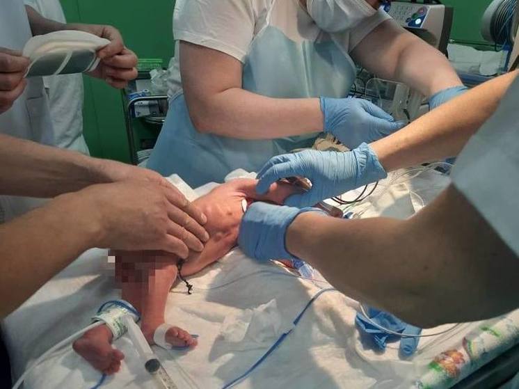 На Ставрополье впервые прооперировали новорожденного с атрезией пищевода