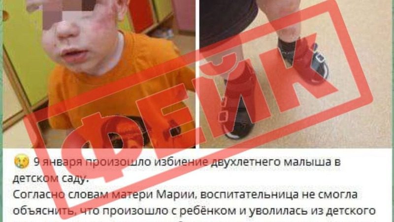 В соцсетях распространили фейк об избиении ребёнка в ставропольском детсаду