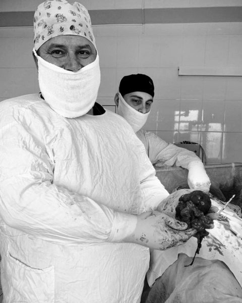 Хирурги Пятигорска удалили 70-летней пациентке почку из-за коралловидных камней