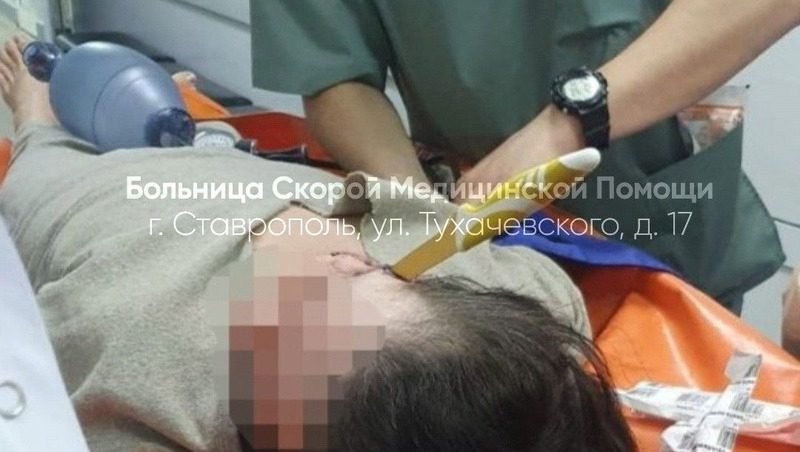 Ставропольские врачи спасли женщину с застрявшим в голове ножом