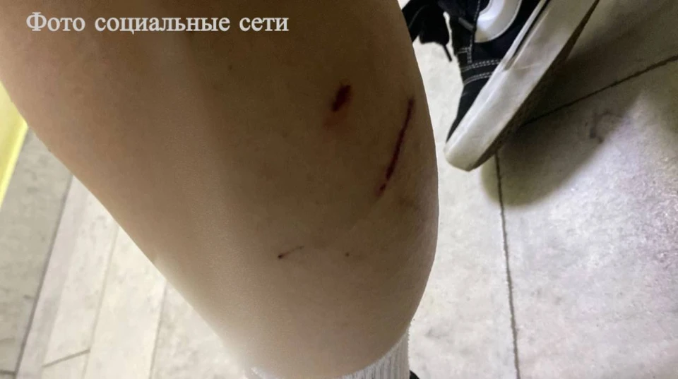 СКР начал проверку после нападения бродячих собак на подростка в Минводах0