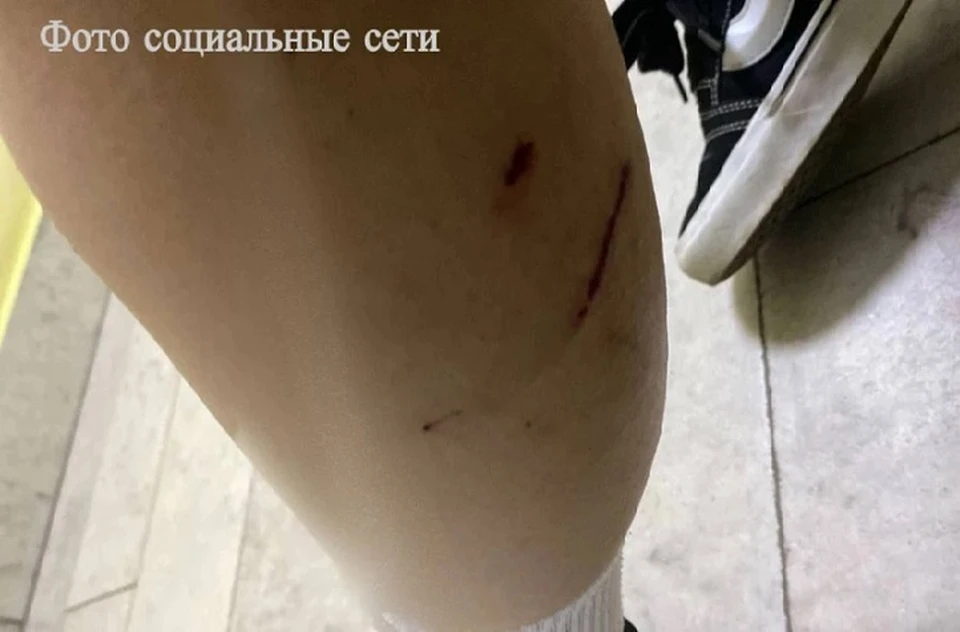 За расследованием нападения собак на подростка в Минводах проследит Бастрыкин0