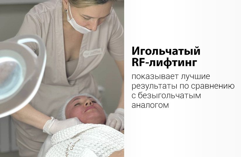 SMAS или RF: какой лифтинг лучше и кому процедуры не подойдут3
