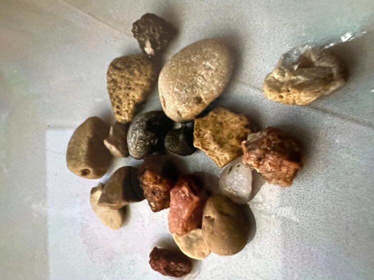 В Ессентуках трёхлетний ребёнок проглотил более 25 камней