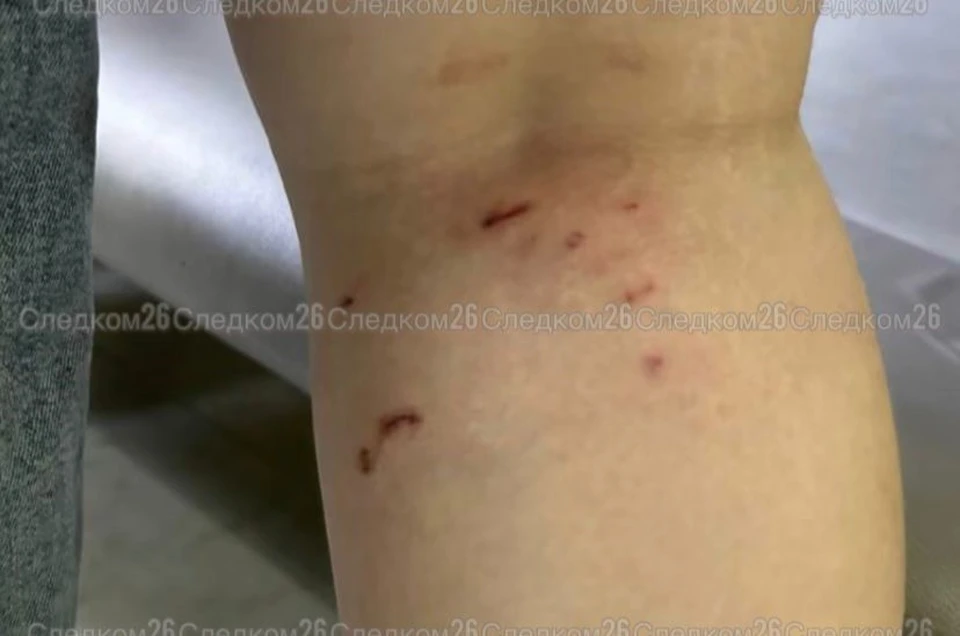 В Минводах возбудили уголовное дело после нападения собак на школьницу0