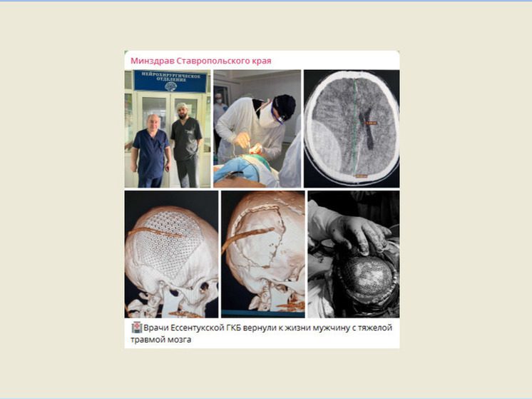 Упал, ударился и лег спать: врачи в Ессентуках спасли впавшего в кому мужчину