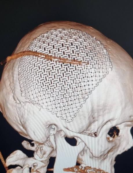 Врачи в Ессентуках спасли парня, впавшего в кому во сне после случайного падения